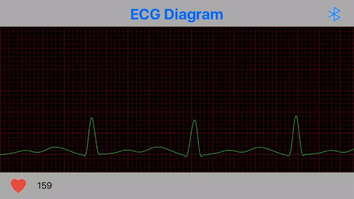 Capturas de pantalla de Jabil-ECG