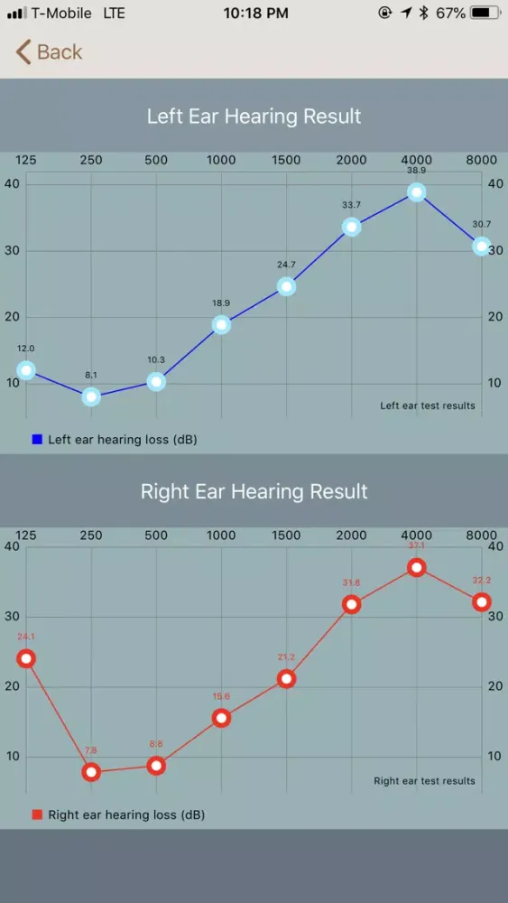 Capturas de pantalla de PerEar: Help You Hear Better