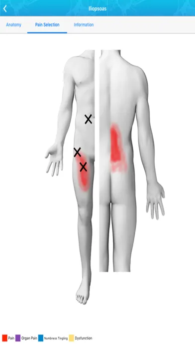 Referred Pain Index Screenshots