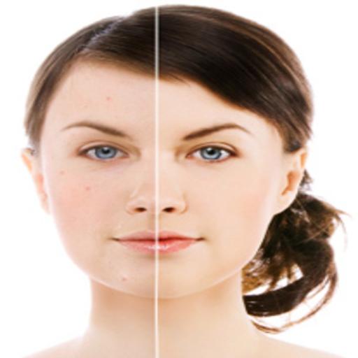 Skin Problem Skin Problem