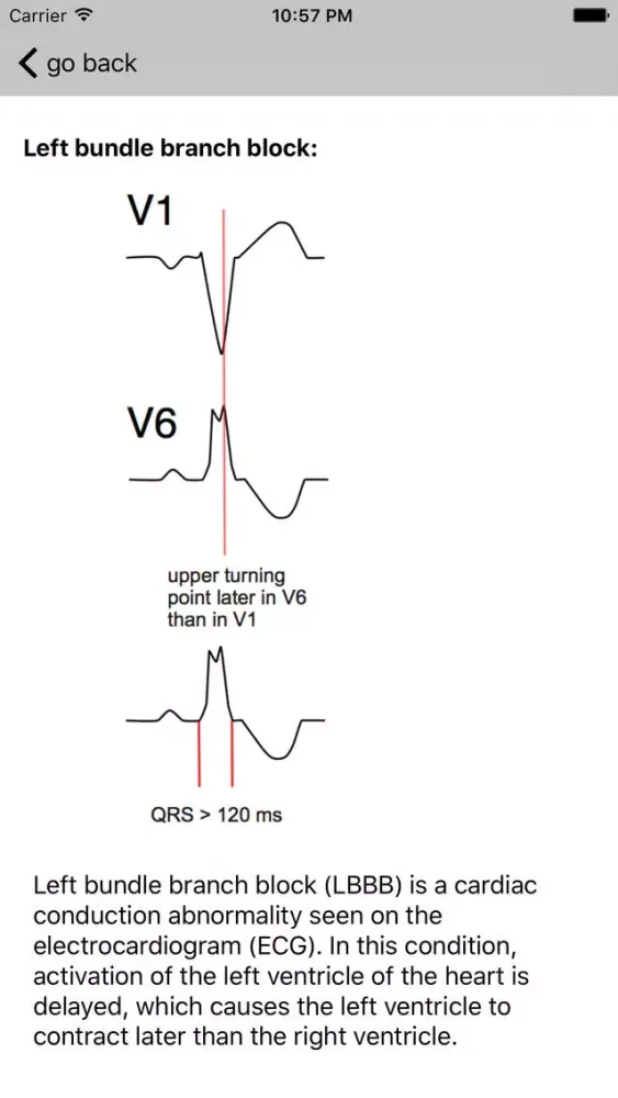 Learn ECG سکرین شاٹس