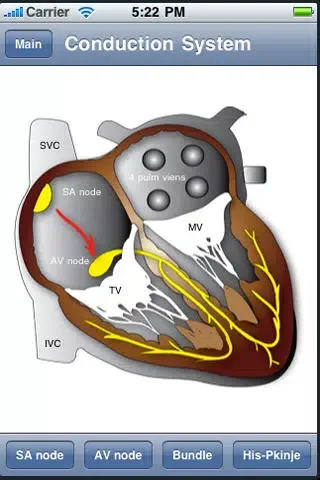 Heart Illustrated स्क्रीनशॉट