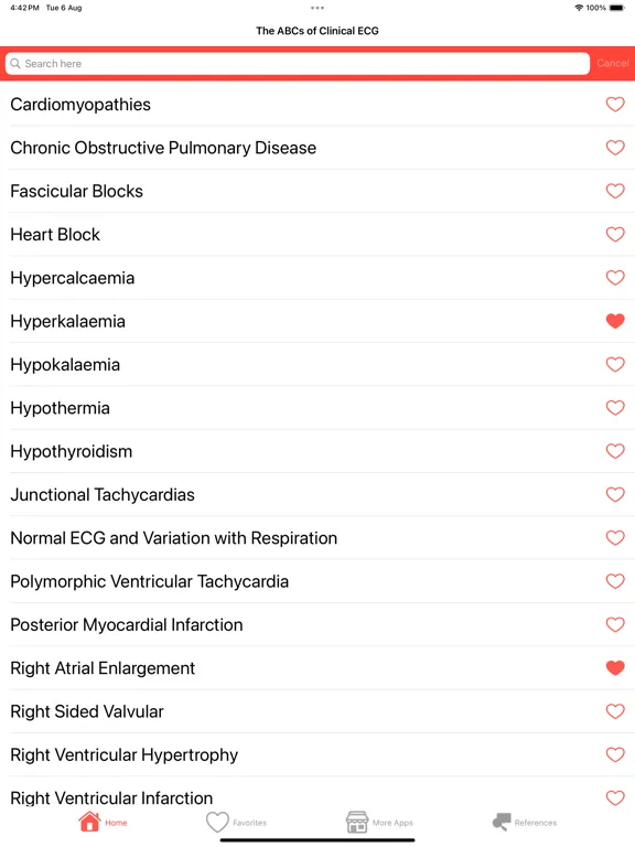 تصاویر Clinical ECG Interpretation iPad 