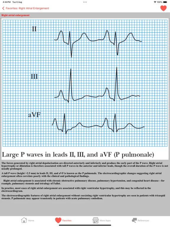 تصاویر Clinical ECG Interpretation iPad 