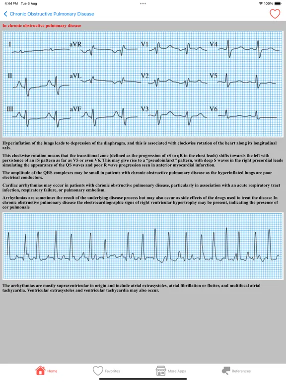 تصاویر Clinical ECG Interpretation iPad 