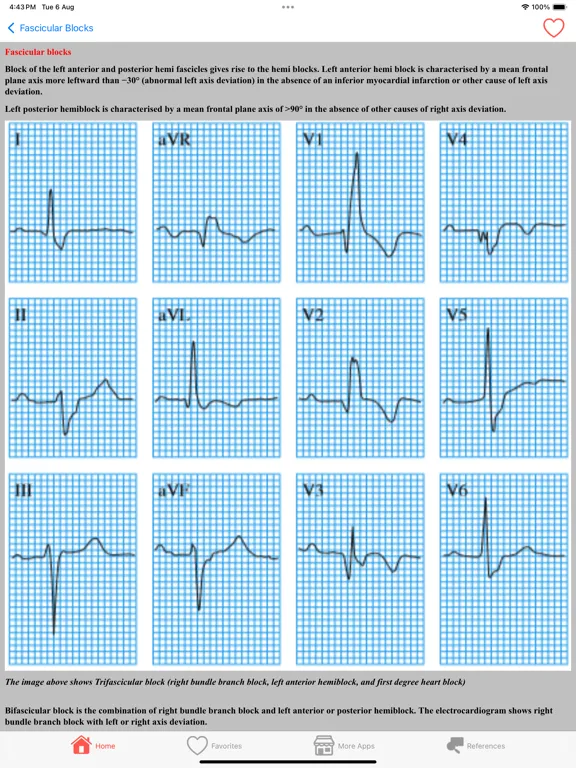 تصاویر Clinical ECG Interpretation iPad 