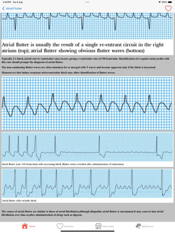 تصاویر Clinical ECG Interpretation iPad 