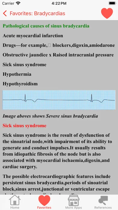 تصاویر Clinical ECG Interpretation