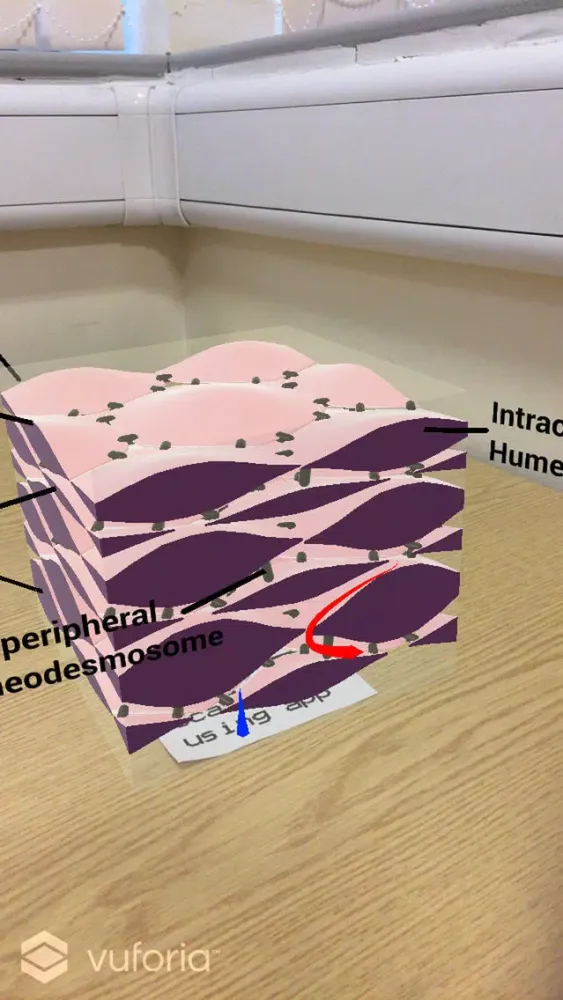 EpidermisAR Ekran Görüntüleri