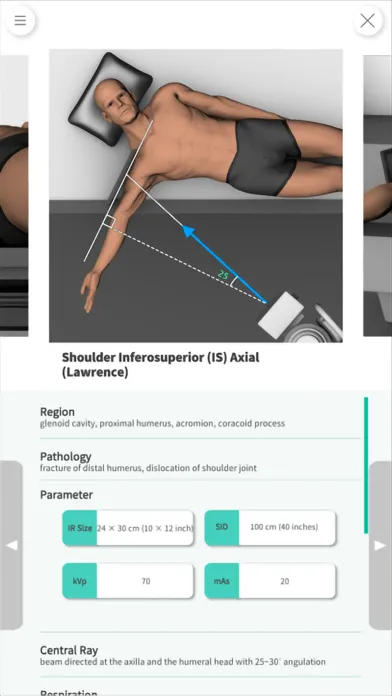 Navi Radiography Lite应用截图