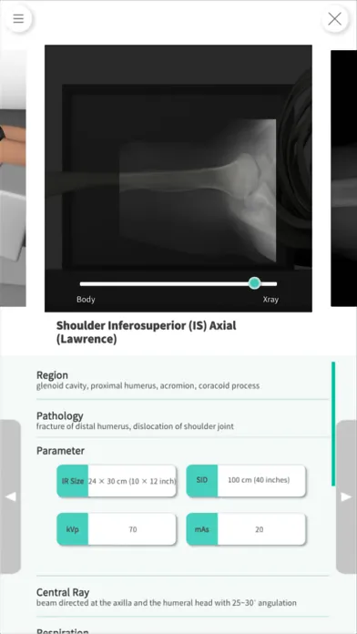 Navi Radiography Lite应用截图
