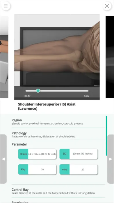 Navi Radiography Lite应用截图