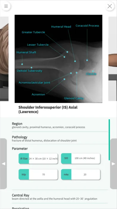 Navi Radiography Lite应用截图