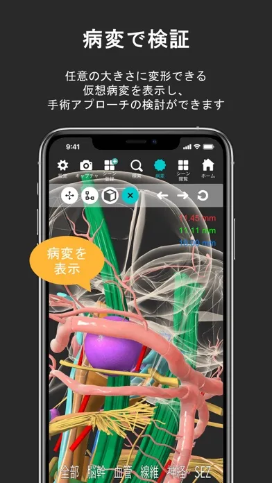 صور 脳観