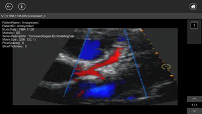 Capturas de pantalla de DICOM Viewer : eMma