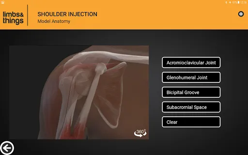 Capturas de pantalla de Shoulder Injection