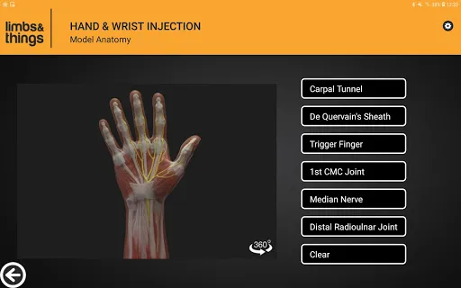 Hand & Wrist Injection Screenshots