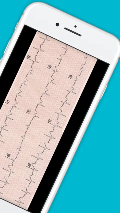 12 Lead ECG Challenge Screenshots