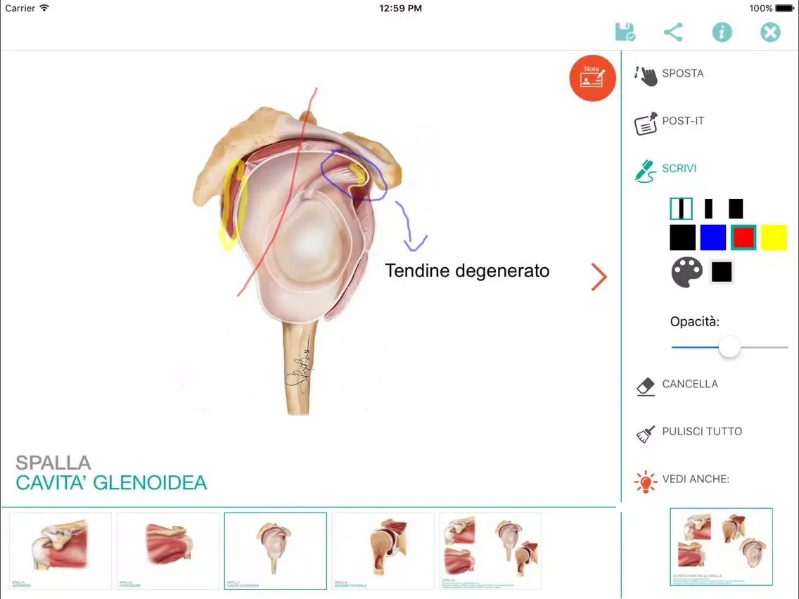 Captures d'écran de PaintAnatomy iPad 