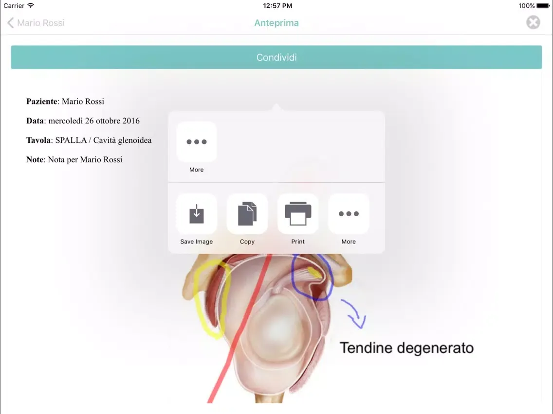 Captures d'écran de PaintAnatomy iPad 