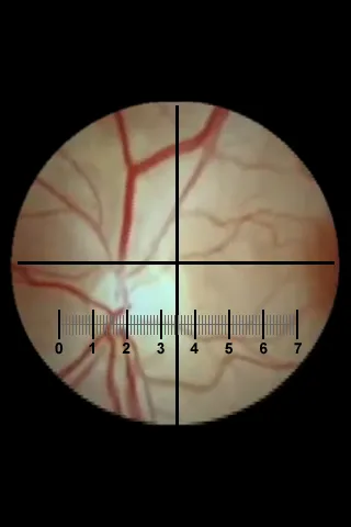 Microscope应用截图