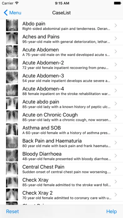 Xrays4Medics應用截圖