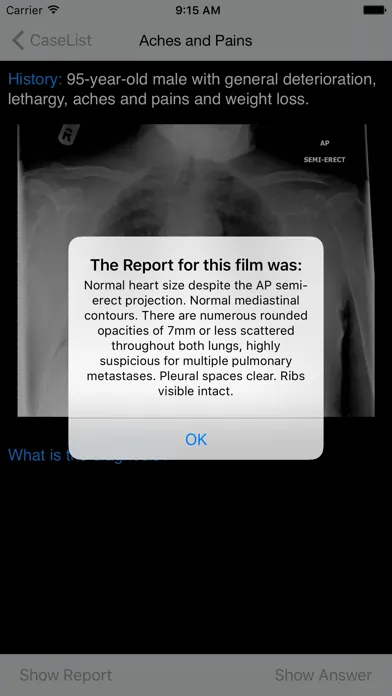Xrays4Medics應用截圖