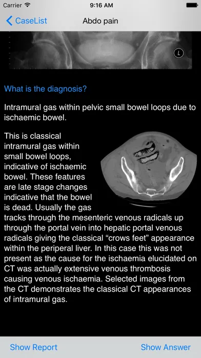 Xrays4Medics應用截圖