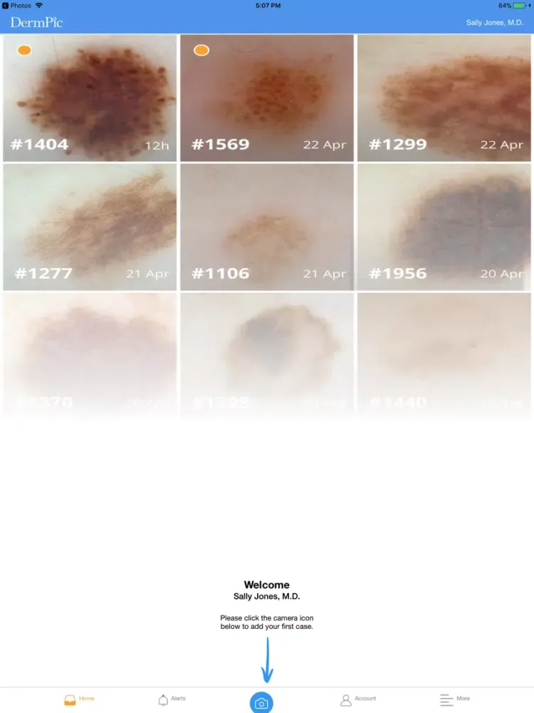 DermPic - Dermoscopy iPad  Screenshots