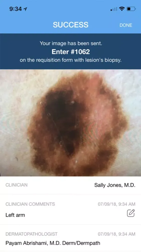 DermPic - Dermoscopy Screenshots