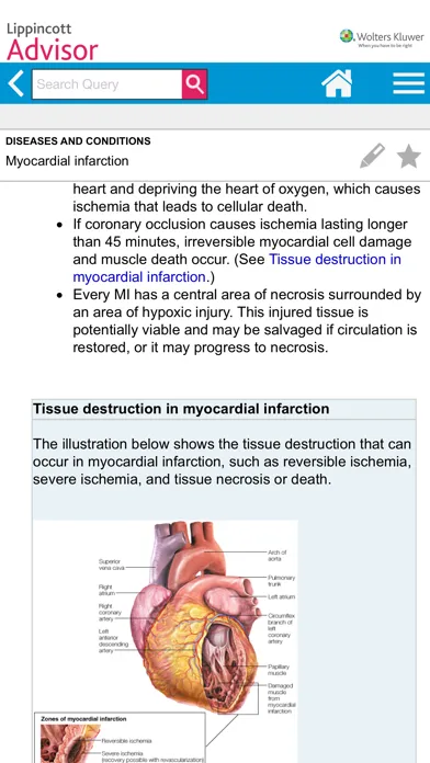 Lippincott Nursing Advisor 스크린샷