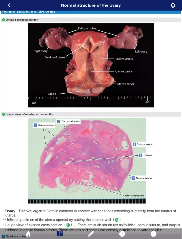 ATLAS OF PATHOLOGY And Comparison With Normal Anatomy Lite iPad  سکرین شاٹس