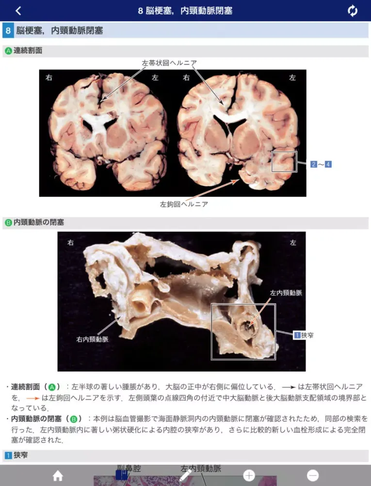 ATLAS OF PATHOLOGY And Comparison With Normal Anatomy Lite iPad  سکرین شاٹس