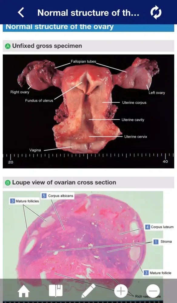 ATLAS OF PATHOLOGY And Comparison With Normal Anatomy Lite سکرین شاٹس
