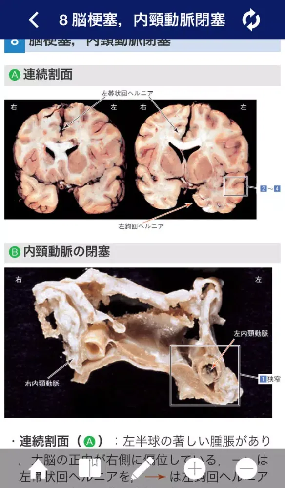 ATLAS OF PATHOLOGY And Comparison With Normal Anatomy Lite سکرین شاٹس