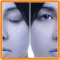 Clones
