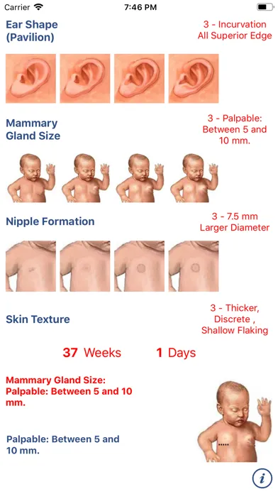 Neonatology: Test Capurro سکرین شاٹس