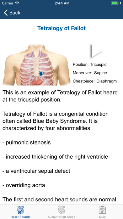 Heart Sounds Auscultation スクリーンショット