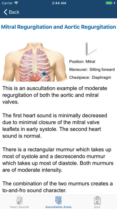 Heart Sounds Auscultation スクリーンショット