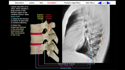 تصاویر Human Skeleton: Gross Anatomy