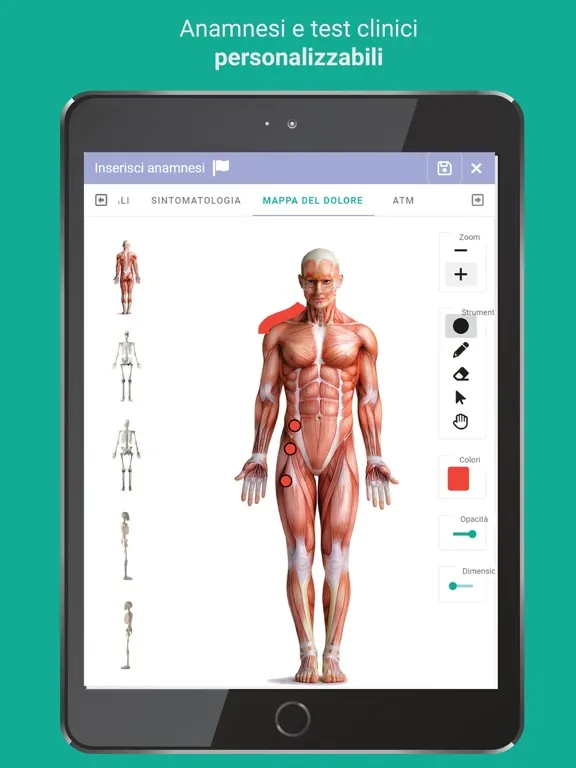 Ảnh chụp màn hình của OsteoEasy iPad 