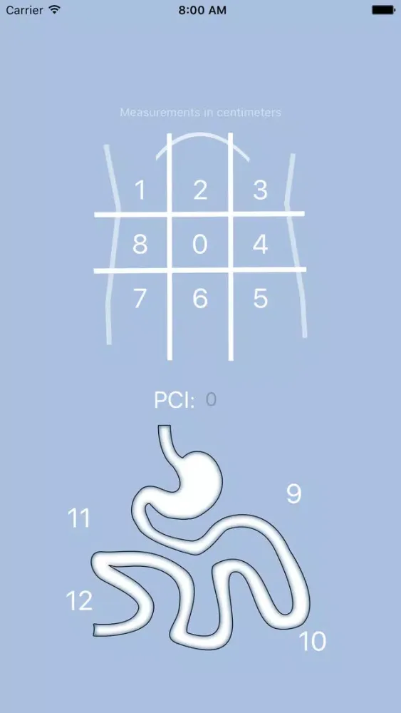 PCI - Peritoneal Carcinomatosis Index স্ক্রিনশট