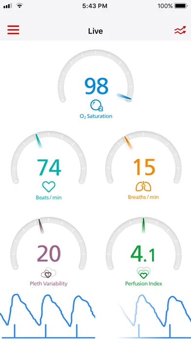 Masimo SafetyNet Screenshots