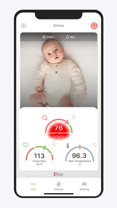 Masimo Stork Screenshots