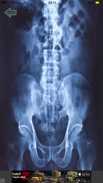 Ảnh chụp màn hình của X-ray Scanner body