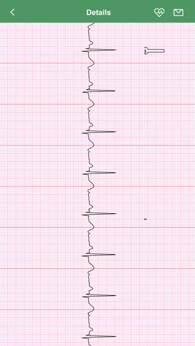 Скриншоты iBP ECG Pro