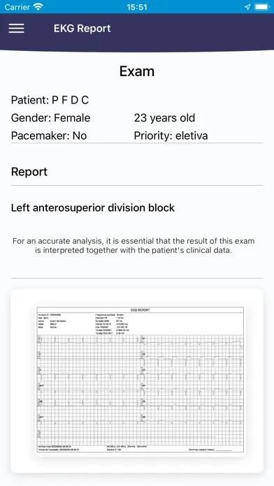 صور EKG Report