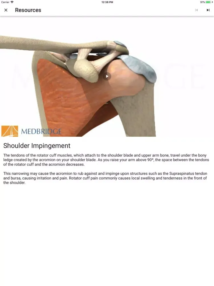 Ảnh chụp màn hình của SOAR FITT for Patients iPad 