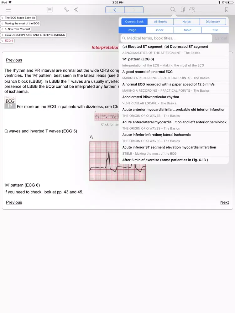 The ECG Made Easy, 8th Edition iPad  Screenshots
