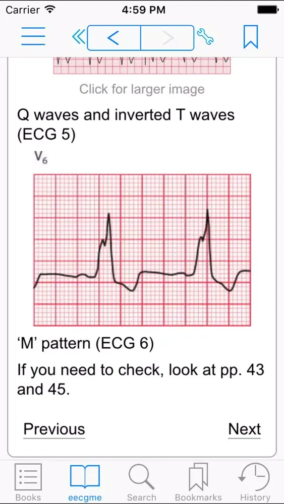 The ECG Made Easy, 8th Edition Screenshots